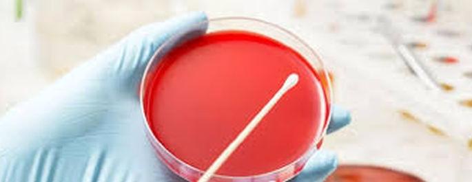 Awaiting report of throat swab samples of 26 persons including three from Kavathal | कवठळ येथील तिघांसह २६ जणांच्या थ्रोट स्वॅब नमुने अहवालाची प्रतिक्षा Awaiting report of throat swab samples of 26 persons including three from Kavathal | कवठळ येथील तिघांसह २६ जणांच्या थ्रोट स्वॅब नमुने अहवालाची प्रतिक्षा
