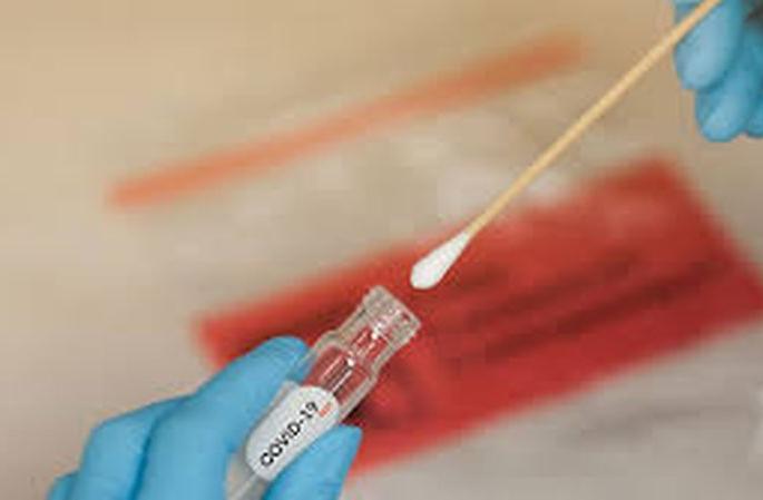 Delay in taking swab samples; The report was not received soon | स्वॅब नमुने घेण्यात दिरंगाई; अहवालही लवकर मिळेना Delay in taking swab samples; The report was not received soon | स्वॅब नमुने घेण्यात दिरंगाई; अहवालही लवकर मिळेना