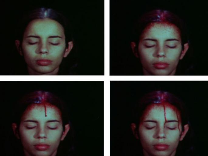 A girl admitted into an italian hospital for sweating blood | अजब ! या तरुणीच्या शरिरातून घामाऐवजी वाहते रक्त, डॉक्टरही आश्चर्यचकित A girl admitted into an italian hospital for sweating blood | अजब ! या तरुणीच्या शरिरातून घामाऐवजी वाहते रक्त, डॉक्टरही आश्चर्यचकित