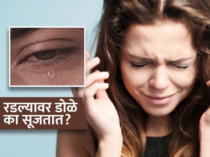 Why do eyes become swollen and red after crying? know the reason | रडल्यावर डोळे सुजतात, लालसर का होतात? पाहा काय आहे याचं वैज्ञानिक कारण...