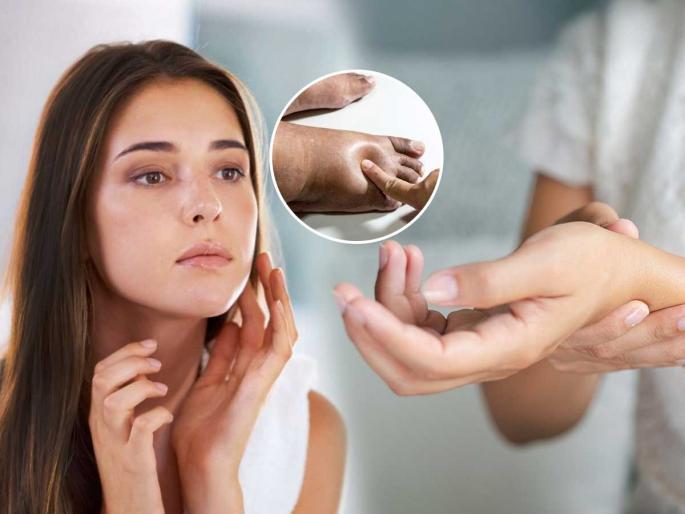 Press the skin with your finger to see if it is swollen. If so, it could be a problem, understand the symptoms and remedies. | त्वचेला बोटाने दाबून पाहा सुज आहे का ? असेल तर असू शकतात 'हे' त्रास, समजून घ्या लक्षणे आणि उपाय