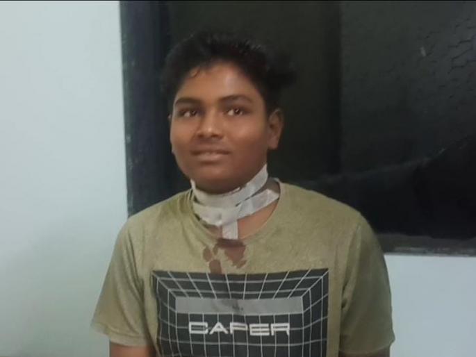 Child's neck injured due to nylon net, incident at Bhandara Lakhandur | पतंगाच्या नायलॉन मांजाने गळा चिरला; बालक गंभीर, लाखांदूर येथील घटना Child's neck injured due to nylon net, incident at Bhandara Lakhandur | पतंगाच्या नायलॉन मांजाने गळा चिरला; बालक गंभीर, लाखांदूर येथील घटना