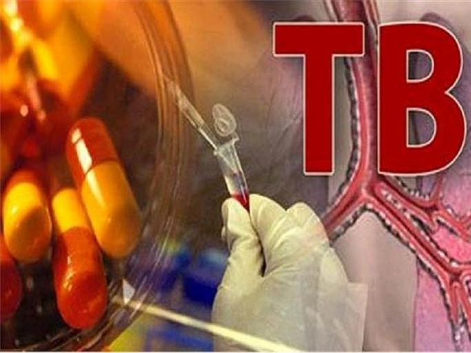 124 squads deployed in Mira Bhayandar for leprosy and tuberculosis research campaign | मीरा-भाईंदरमध्ये कुष्ठरोग, क्षयरोग शोध मोहिमेसाठी १२४ पथके तैनात 124 squads deployed in Mira Bhayandar for leprosy and tuberculosis research campaign | मीरा-भाईंदरमध्ये कुष्ठरोग, क्षयरोग शोध मोहिमेसाठी १२४ पथके तैनात