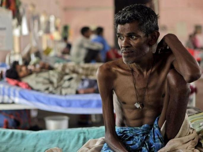 tuberculosis patients increases after corona situation under control | कोरोनानंतर क्षयरोग रुग्णांत पुन्हा वाढ; २०२१ मध्ये दोन लाख ६२३ रुग्णांची नोंद tuberculosis patients increases after corona situation under control | कोरोनानंतर क्षयरोग रुग्णांत पुन्हा वाढ; २०२१ मध्ये दोन लाख ६२३ रुग्णांची नोंद