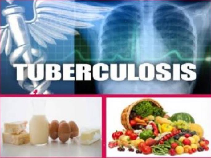Patients are getting the support of the nourishment nutrition plan | निक्षय पोषण योजनेचा क्षय रुग्णांना मिळतोय आधार Patients are getting the support of the nourishment nutrition plan | निक्षय पोषण योजनेचा क्षय रुग्णांना मिळतोय आधार