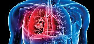 coronavirus: Reduces the risk of coronavirus in severe tuberculosis patients, experts say | coronavirus: क्षयाच्या गंभीर रुग्णांना कोरोनाचा धोका कमी , तज्ज्ञांचे मत coronavirus: Reduces the risk of coronavirus in severe tuberculosis patients, experts say | coronavirus: क्षयाच्या गंभीर रुग्णांना कोरोनाचा धोका कमी , तज्ज्ञांचे मत