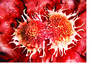 Ratnagiri: 1 suspected cancer patient | रत्नागिरीत ५७३ कॅन्सरचे संशयित रुग्ण Ratnagiri: 1 suspected cancer patient | रत्नागिरीत ५७३ कॅन्सरचे संशयित रुग्ण