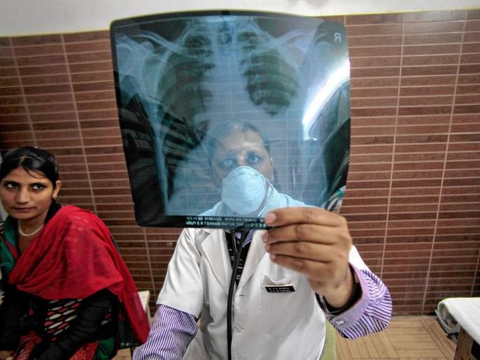 Maharashtra, UP is coughing dangerously! Second in the country in the number of tuberculosis patients; Information from the Minister of Health | महाराष्ट्र, यूपी धोकादायक खोकतोय! क्षयरोग रुग्ण संख्येत देशात दुसरा; आरोग्यमंत्र्यांची माहिती