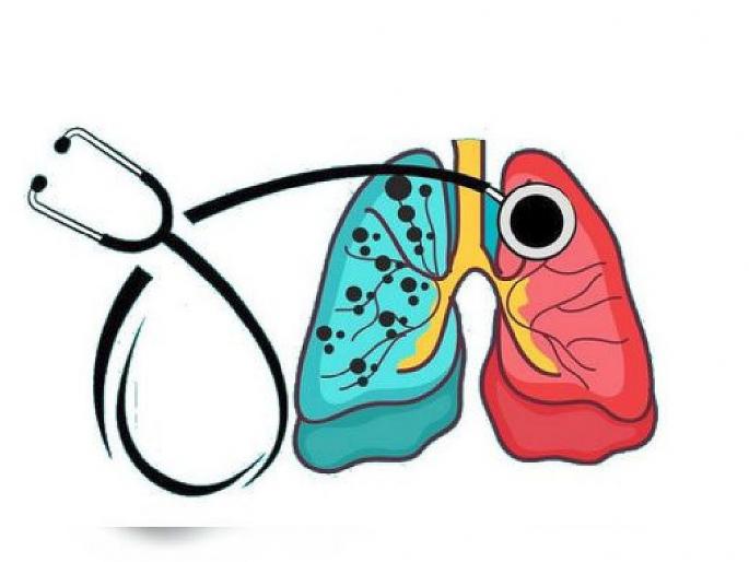 World Tuberculosis Day : one death in every six minute due to tuberculosis in india | भारतात सर्वाधिक क्षयरुग्ण; दर सहा मिनिटाला होतो एका व्यक्तीचा मृत्यू World Tuberculosis Day : one death in every six minute due to tuberculosis in india | भारतात सर्वाधिक क्षयरुग्ण; दर सहा मिनिटाला होतो एका व्यक्तीचा मृत्यू