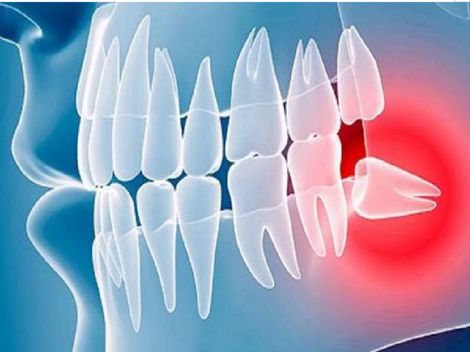 Is there a relationship between wisdom teeth and intelligence? More misconceptions about beards | अक्कल दाढ अन् हुशारीचा संबंध आहे का? या दाढीविषयी गैरसमजच अधिक Is there a relationship between wisdom teeth and intelligence? More misconceptions about beards | अक्कल दाढ अन् हुशारीचा संबंध आहे का? या दाढीविषयी गैरसमजच अधिक