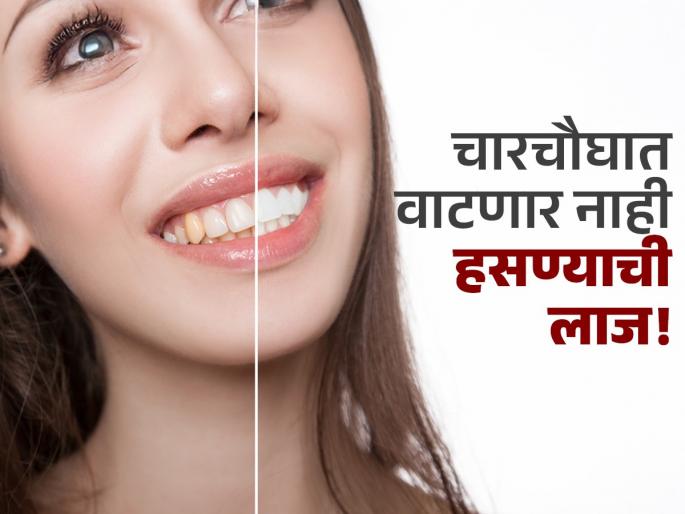 Mix baking soda in toothpaste to clean yellow teeth | पिवळे दात चमकदार करण्याचा सोपा उपाय, फक्त 'ही' एक गोष्ट टूथपेस्टमध्ये कालवून दातांना लावा..