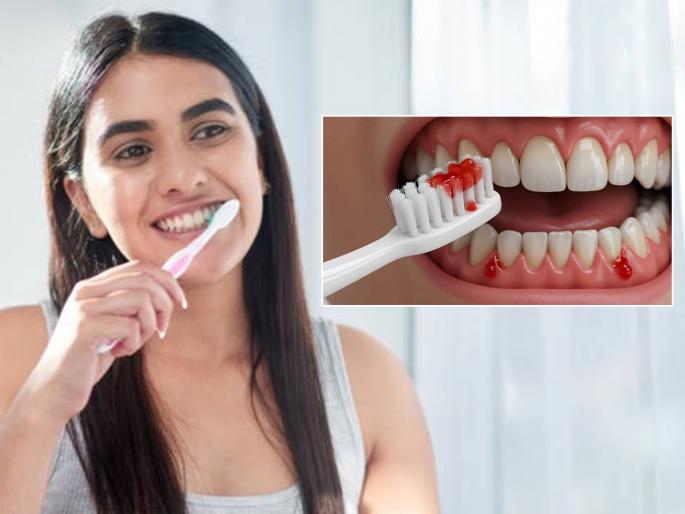 See what goes wrong while brushing your teeth and what to do, oral care tips | चुकीच्या पद्धतीने ब्रश वापरणे पडते महागात, पाहा दात घासताना काय चुकते आणि काय करायला हवे See what goes wrong while brushing your teeth and what to do, oral care tips | चुकीच्या पद्धतीने ब्रश वापरणे पडते महागात, पाहा दात घासताना काय चुकते आणि काय करायला हवे