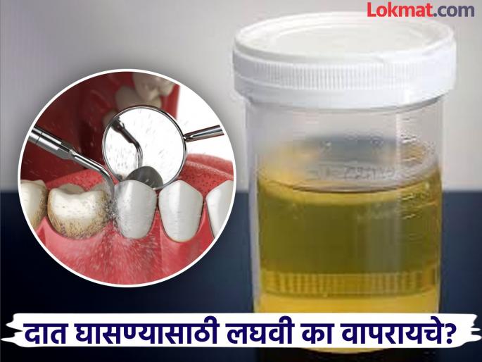 Teeth whitening history : Old people used to clean with urine | अजबच! कधी लघवीनं स्वच्छ केले जात होते दात, तर कधी न्हावी येऊन घासून जात होता! Teeth whitening history : Old people used to clean with urine | अजबच! कधी लघवीनं स्वच्छ केले जात होते दात, तर कधी न्हावी येऊन घासून जात होता!
