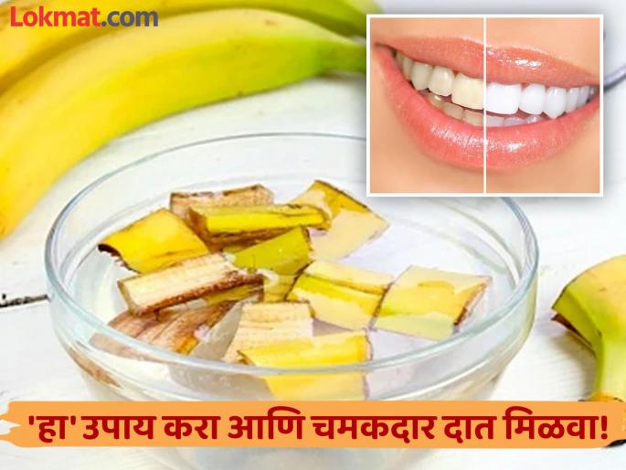 Use banana peel and baking soda for making teeth white at home naturally | पिवळ्या दातांना वैतागलात, केळीच्या सालीत 'ही' एक गोष्ट मिक्स करून लावा; चमकदार होतील दात! Use banana peel and baking soda for making teeth white at home naturally | पिवळ्या दातांना वैतागलात, केळीच्या सालीत 'ही' एक गोष्ट मिक्स करून लावा; चमकदार होतील दात!