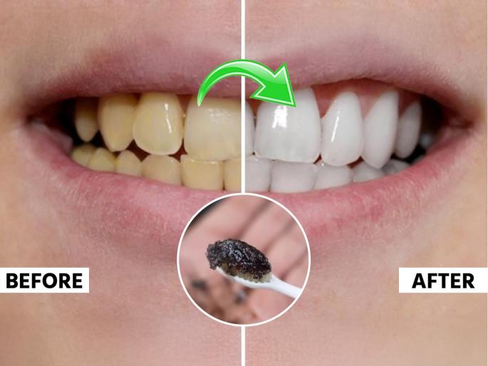 Fitkari & Salt For Yellow Teeth Whitening Home Remedies How to remove yellow spots from your teeth Fitkari For Yellow Teeth Whitening What is the best home remedy for yellow teeth | दातांवरील पिवळा थर होईल गायब! आजीबाईच्या बटव्यातील 'तुरटीचा' उपाय-ओरल हेल्थ राहील उत्तम...