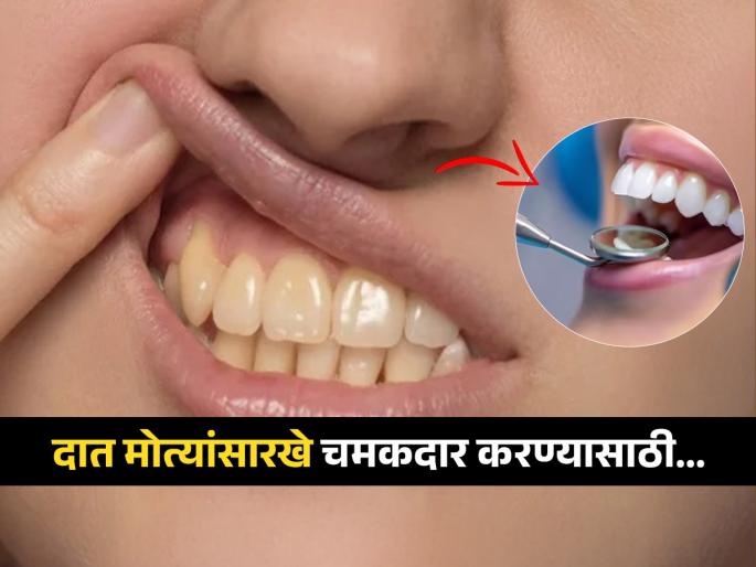 Doctor tells how to use baking soda to whiten teeth naturally | चिमुटभर पावडरनं दात होतील मोत्यांसारखे चमकदार, तोंडाची दुर्गंधीही जाईल; पाहा काय आहे उपाय