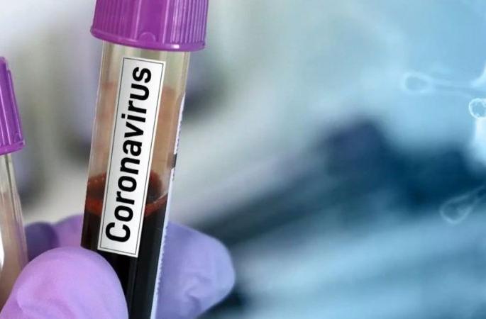 The number of corona victims in the sub capital is close to 300 | उपराजधानीत कोरोनाबाधितांची संख्या ३०० च्या दिशेने The number of corona victims in the sub capital is close to 300 | उपराजधानीत कोरोनाबाधितांची संख्या ३०० च्या दिशेने