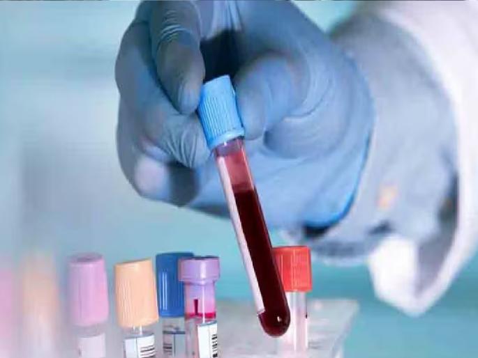 Four different test reports of blood from the same patient, Ask MLAs in Legislative Council | एकाच रुग्णाच्या रक्ताचे चार वेगवेगळे चाचणी अहवाल, विधानपरिषदेत आमदारांनी विचारला जाब Four different test reports of blood from the same patient, Ask MLAs in Legislative Council | एकाच रुग्णाच्या रक्ताचे चार वेगवेगळे चाचणी अहवाल, विधानपरिषदेत आमदारांनी विचारला जाब