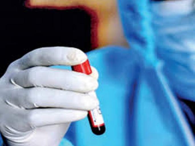 Another 45 corona positive patients were found in Akola district | अकोला जिल्ह्यात आणखी ४५ कोरोना पॉझिटिव्ह रुग्ण आढळले Another 45 corona positive patients were found in Akola district | अकोला जिल्ह्यात आणखी ४५ कोरोना पॉझिटिव्ह रुग्ण आढळले