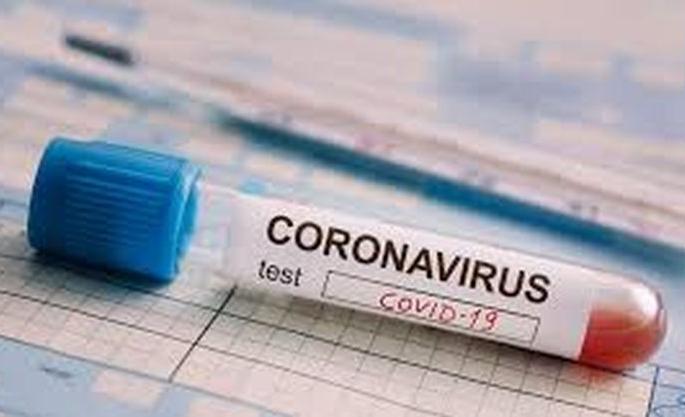 CoronaVirus in Akola: 19 more positive; The total number of patients is 3195 | CoronaVirus in Akola :  आणखी १९ पॉझिटिव्ह; एकूण रुग्णसंख्या ३१९५ CoronaVirus in Akola: 19 more positive; The total number of patients is 3195 | CoronaVirus in Akola :  आणखी १९ पॉझिटिव्ह; एकूण रुग्णसंख्या ३१९५