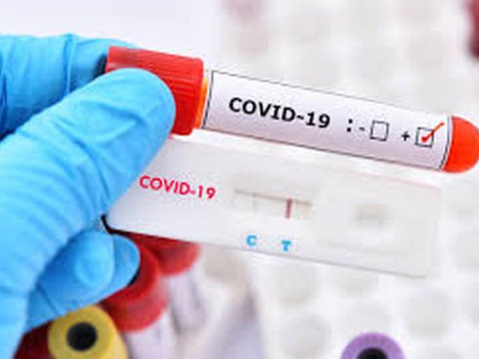 Khamgaon taluka leads in Covid-19 test! | कोविड-१९ टेस्टमध्ये खामगाव तालुका आघाडीवर! Khamgaon taluka leads in Covid-19 test! | कोविड-१९ टेस्टमध्ये खामगाव तालुका आघाडीवर!