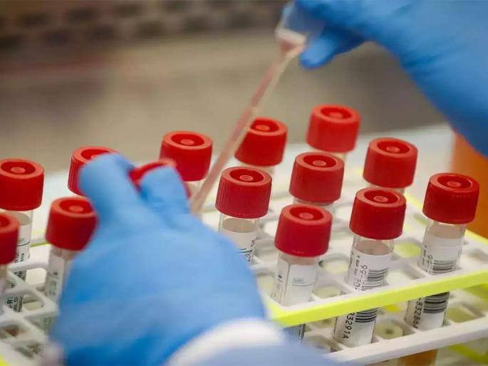 which test is used in dengue, corona and zika | डेंग्यु, कोरोना आणि झिका तीन्ही रोगांसाठी एकच चाचणी...कोणती? घ्या जाणून which test is used in dengue, corona and zika | डेंग्यु, कोरोना आणि झिका तीन्ही रोगांसाठी एकच चाचणी...कोणती? घ्या जाणून