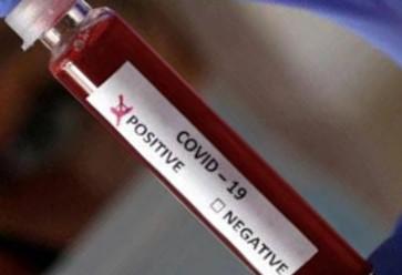 Coronavirus in Akola: 31 'positive' in a day, 14 coronavirus free | Coronavirus in Akola : दिवसभरात ३१ ‘पॉझिटिव्ह’, १४ कोरोनामुक्त Coronavirus in Akola: 31 'positive' in a day, 14 coronavirus free | Coronavirus in Akola : दिवसभरात ३१ ‘पॉझिटिव्ह’, १४ कोरोनामुक्त