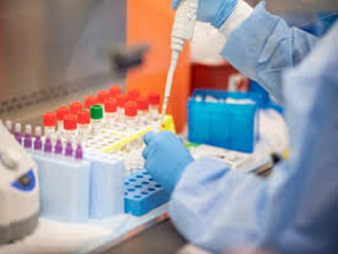 Corona testing lab to begin in June; Sting capacity will increase | CoronaVirus News: कोरोना टेस्टिंग लॅब जूनमध्ये होणार सुरू; स्टिंगची क्षमता वाढणार  Corona testing lab to begin in June; Sting capacity will increase | CoronaVirus News: कोरोना टेस्टिंग लॅब जूनमध्ये होणार सुरू; स्टिंगची क्षमता वाढणार