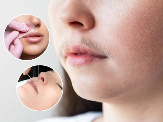 Threading vs waxing for facial hair removal which is better Doctor recommended methods for painless facial hair removal How to reduce irritation | चेहऱ्यावरचे केस खूप लवकर वाढतात? थ्रेडिंग- वॅक्सिंग काय करावं? डॉक्टरांचा सल्ला, दुखणार नाही- जळजळही कमी