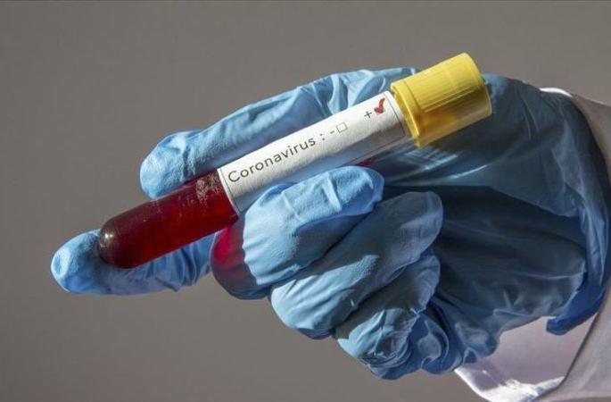 Five more infected in Amravati; Number of corona victims 111 | अमरावतीमध्ये आणखी पाच संक्रमित; कोरोनाग्रस्तांची संख्या १११ Five more infected in Amravati; Number of corona victims 111 | अमरावतीमध्ये आणखी पाच संक्रमित; कोरोनाग्रस्तांची संख्या १११