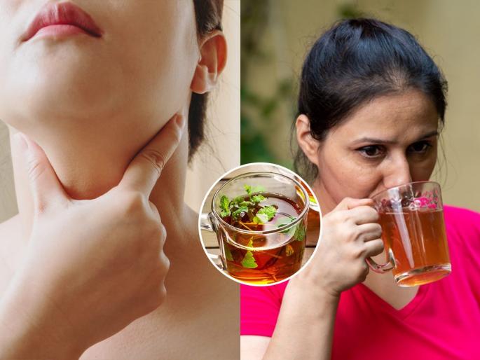 2 Simple ways to treat thyroid problems at home Natural treatments and home remedies for thyroid problems Home Remedies for Thyroid Cure Thyroid Problem Naturally | थायरॉईडमुळे गळ्याला सूज आली? पोषणतज्ज्ञांचा सल्ला- २ गोष्टी करा, काळजी नको उपाय करा...