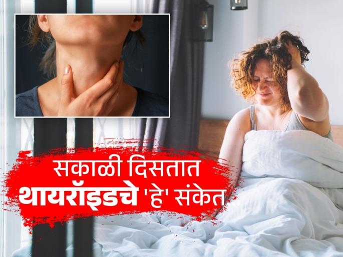 These thyroid symptoms shown in morning, dont try to avoid | सकाळी झोपेतून उठल्या उठल्या दिसतात थायरॉइडची 'ही' लक्षणं, वाचा तुम्हाला तर नाही ना?