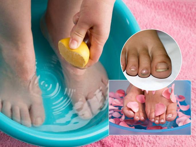 healthcare tips, If dirt gets stuck in toenails, there is a possibility of serious skin disease, a solution to avoid infection along with bad smell | पायाच्या नखांत घाण अडकली की गंभीर त्वचारोग होण्याची शक्यता, दुर्गंधीसह इन्फेक्शन टाळण्याचा उपाय