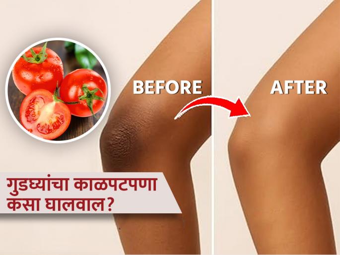 How to use tomato tan pack to remove darkness of knees and elbows | गुडघे आणि हाताच्या कोपरांचा काळपटपणा लगेच होईल दूर, टोमॅटोचा ‘हा’ खास उपाय करा