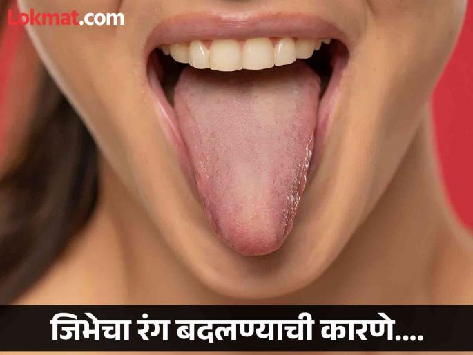 What color should your tongue be and what do different colors indicate | जिभेचा रंग उलगडतो तुमच्या आरोग्याचं रहस्य, जाणून घ्या कधी असते चिंतेची बाब! What color should your tongue be and what do different colors indicate | जिभेचा रंग उलगडतो तुमच्या आरोग्याचं रहस्य, जाणून घ्या कधी असते चिंतेची बाब!