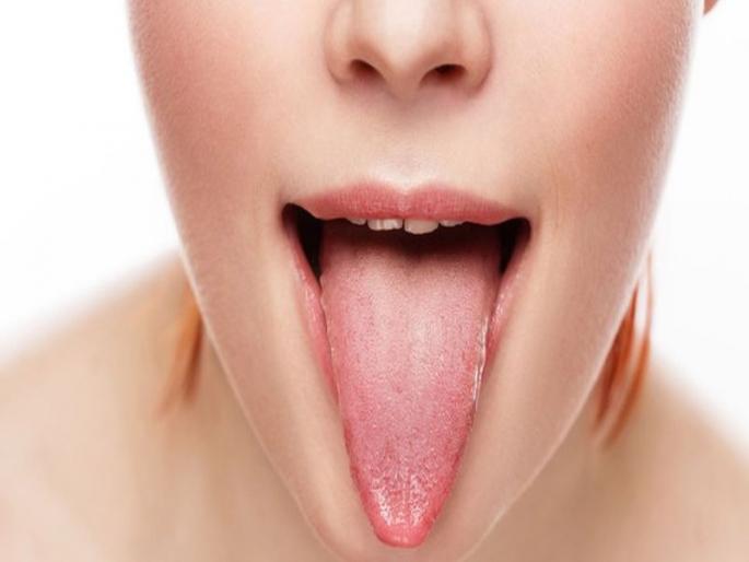 Know What your tongue says about your health | जिभेच्या रंगावरून ओळखा तुम्हाला कोणता आजार झालाय Know What your tongue says about your health | जिभेच्या रंगावरून ओळखा तुम्हाला कोणता आजार झालाय