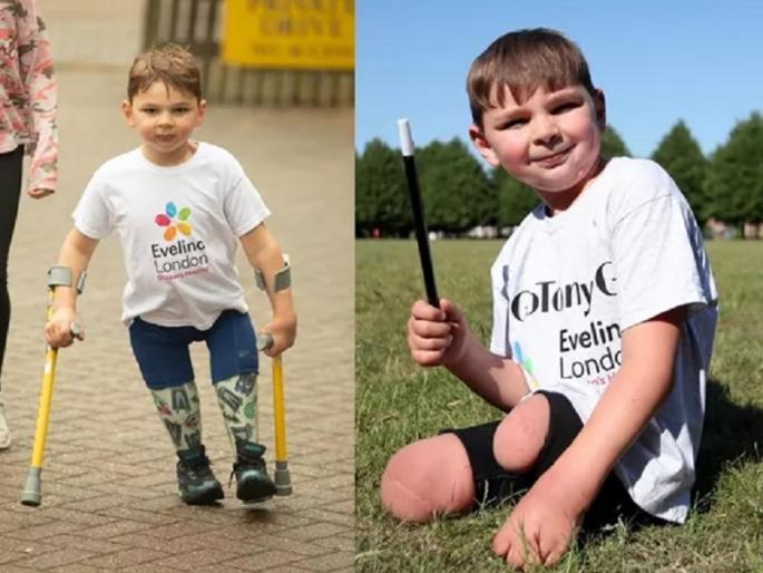 tony hudgell british double amputee aged five raises one million pounds | अवघ्या ५ वर्षांच्या दिव्यांगाने १० किमी चालून रुग्णालयासाठी जमवला ९ कोटींचा निधी tony hudgell british double amputee aged five raises one million pounds | अवघ्या ५ वर्षांच्या दिव्यांगाने १० किमी चालून रुग्णालयासाठी जमवला ९ कोटींचा निधी