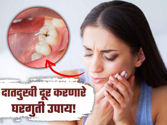 Applying these 2 things on teeth helps in tooth pain | दातांचं दुखणं दूर करण्यासाठी वापरा किचनमधील 'या' दोन गोष्टी, लगेच मिळेल आराम! Applying these 2 things on teeth helps in tooth pain | दातांचं दुखणं दूर करण्यासाठी वापरा किचनमधील 'या' दोन गोष्टी, लगेच मिळेल आराम!