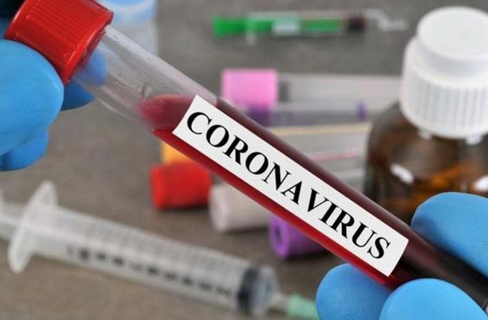 Another 33 patients were admitted in Akola; Total number of patients is 3053 | अकोल्यात आणखी ३३ रुग्ण वाढले; एकूण रुग्णसंख्या ३०५३