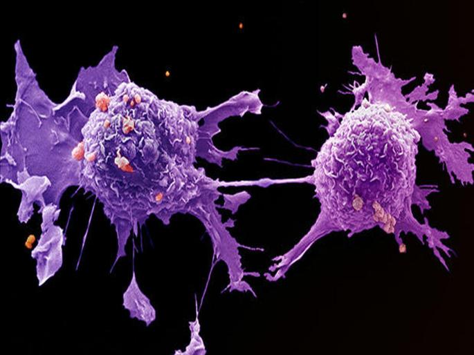 Your daily habits may be incressed risk for cancer | तुमच्या 'या' सवयींमुळे होऊ शकता जीवघेण्या आजारांचे शिकार, वेळीच व्हा सावध Your daily habits may be incressed risk for cancer | तुमच्या 'या' सवयींमुळे होऊ शकता जीवघेण्या आजारांचे शिकार, वेळीच व्हा सावध