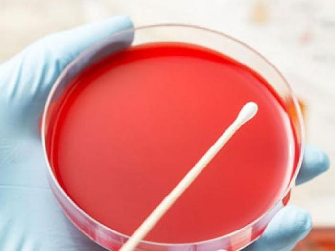 CoronaVirus: Waiting for the 'throat swab' report of 'those' five people | CoronaVirus : ‘त्या’ पाच जणांच्या ‘थ्रोट स्वॅब’ अहवालाची प्रतिक्षा CoronaVirus: Waiting for the 'throat swab' report of 'those' five people | CoronaVirus : ‘त्या’ पाच जणांच्या ‘थ्रोट स्वॅब’ अहवालाची प्रतिक्षा