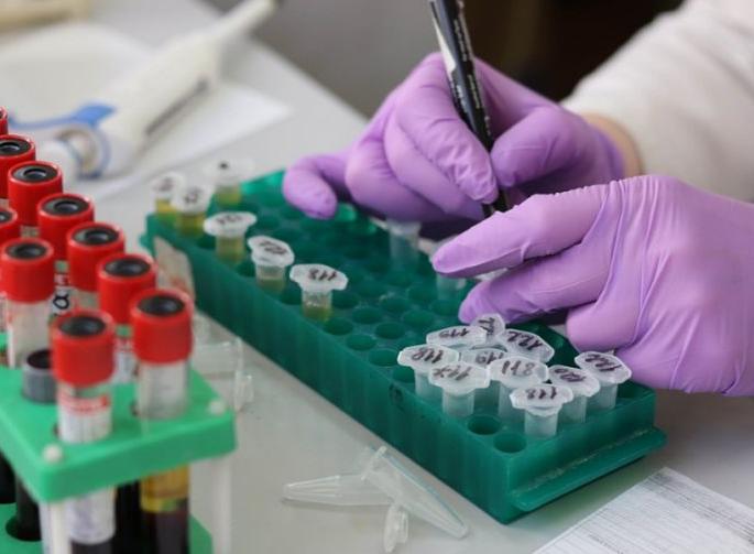 purpose of 'testing', 'tracing' gone invain in Akola ; Getting test report late | अकोल्यात 'टेस्टिंग', 'ट्रेसिंग'च्या मुळ उद्देशालाच हरताळ; चाचणी अहवाल मिळतोय उशिरा