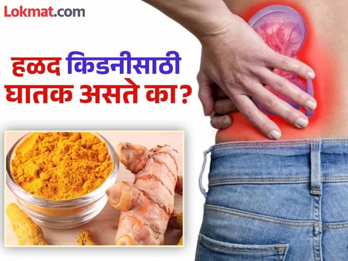Does eating turmeric pose a risk of kidney stones? Know what expert says | हळदीमुळे किडनी स्टोनचा धोका वाढतो का? हळद किती सेफ आणि किती घातक? Does eating turmeric pose a risk of kidney stones? Know what expert says | हळदीमुळे किडनी स्टोनचा धोका वाढतो का? हळद किती सेफ आणि किती घातक?