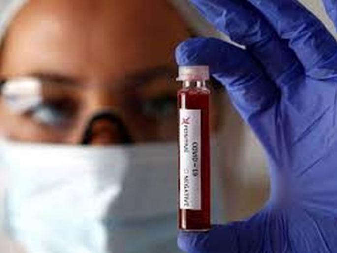 CoronaVirus in Akola: Death of two more; Eight new positives, 15 corona free | CoronaVirus in Akola : आणखी दोघांचा मृत्यू; आठ नवे पॉझिटिव्ह, १५ कोरोनामुक्त CoronaVirus in Akola: Death of two more; Eight new positives, 15 corona free | CoronaVirus in Akola : आणखी दोघांचा मृत्यू; आठ नवे पॉझिटिव्ह, १५ कोरोनामुक्त