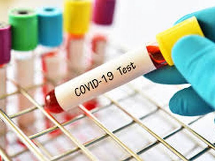 CoronaVirus: Two more die; 30 positive | CoronaVirus : आणखी दोघांचा मृत्यू; ३० पॉझिटिव्ह CoronaVirus: Two more die; 30 positive | CoronaVirus : आणखी दोघांचा मृत्यू; ३० पॉझिटिव्ह
