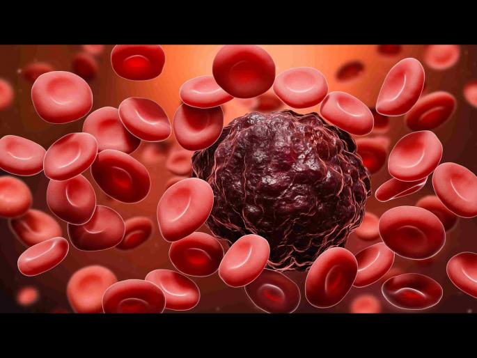 Early sign and symptoms of blood cancer or leukemia | ही छोटी छोटी लक्षण सांगतात वाढत आहे ब्लड कॅन्सरचा धोका, वेळीच व्हा सावध! Early sign and symptoms of blood cancer or leukemia | ही छोटी छोटी लक्षण सांगतात वाढत आहे ब्लड कॅन्सरचा धोका, वेळीच व्हा सावध!