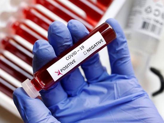 woman returned to kalyan dombivali from UK tested corona positive | CoronaVirus News: ब्रिटनहून आलेली एक तरुणी कोरोना पॉझिटिव्ह; कल्याण-डोंबिवलीकरांची चिंता वाढली woman returned to kalyan dombivali from UK tested corona positive | CoronaVirus News: ब्रिटनहून आलेली एक तरुणी कोरोना पॉझिटिव्ह; कल्याण-डोंबिवलीकरांची चिंता वाढली