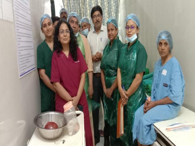 In a central hospital, a tumor of about 1 kg came out of the woman's stomach | मध्यवर्ती रुग्णालयात महिलेच्या पोटातून निघाली अड्डीच किलोची गाठ In a central hospital, a tumor of about 1 kg came out of the woman's stomach | मध्यवर्ती रुग्णालयात महिलेच्या पोटातून निघाली अड्डीच किलोची गाठ