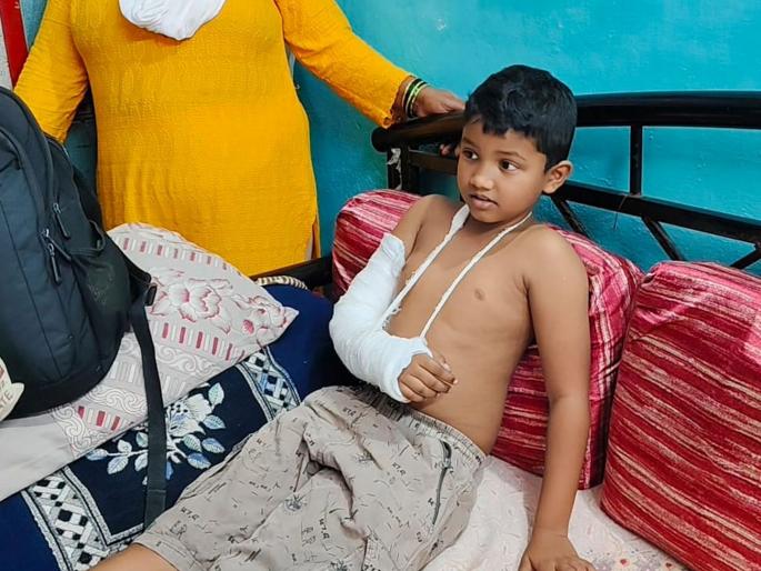 A 7-year-old boy fractured his arm in Guru Nanak School, kept sitting for an hour without treatment, complaint to the Child Welfare Committee  | गुरुनानक शाळेत ७ वर्षाच्या मुलाचा हात फ्रॅक्चर, उपचारा विना बसून ठेवले एक तास, बाल कल्याण समितीकडे तक्रार  A 7-year-old boy fractured his arm in Guru Nanak School, kept sitting for an hour without treatment, complaint to the Child Welfare Committee  | गुरुनानक शाळेत ७ वर्षाच्या मुलाचा हात फ्रॅक्चर, उपचारा विना बसून ठेवले एक तास, बाल कल्याण समितीकडे तक्रार