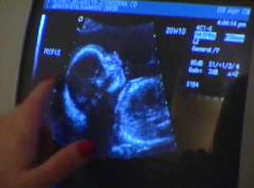 Arvi abortion case! 70 sonographs performed in 10 days at Kadam Hospital | आर्वी गर्भपात प्रकरण! ‘कदम’ रुग्णालयात १० दिवसात झाल्या ७० सोनोग्राफी